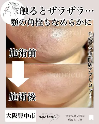 ヘッドスパ専門/豊中 apricotのエステ・リラクイメージ