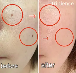 TRINIENCE 南流山店のエステ・リラクイメージ