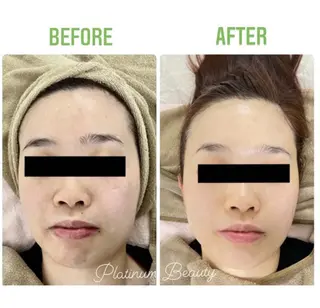 プラティーヌ ボーテのその他イメージ