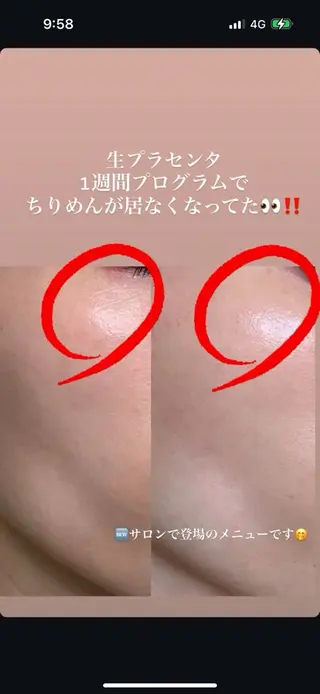 女性専用ボディメイク　Ma-Na 【マーナ】所属・女性専用ボディメイク Ma-Na【マーナ】のエステ・リラクイメージ