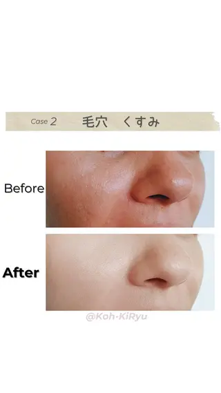 体質改善✨美肌育サロ ン 香嬉琉🌿きよかのエステ・リラクイメージ