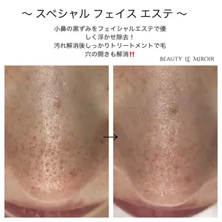 ビューティー ミロワールのエステ・リラクイメージ