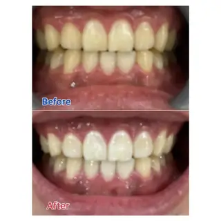 M渋谷 ホワイトニングのエステ・リラクイメージ