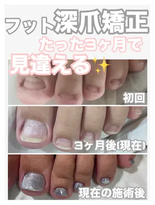 ネイル nail salon petillantのネイルデザイン