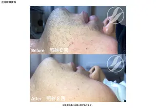 メンズ Kanaloa beauty salon所属・腸もみ・メンズ脱毛・ 毛穴洗浄〜カナロア〜のエステ・リラクイメージ