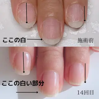 木村 千晴のネイルデザイン