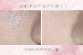レイビス名古屋♡ フェイシャルのエステ・リラクイメージ
