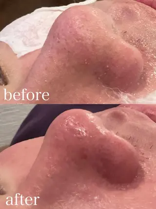 【Beauel】 ここあのエステ・リラクイメージ