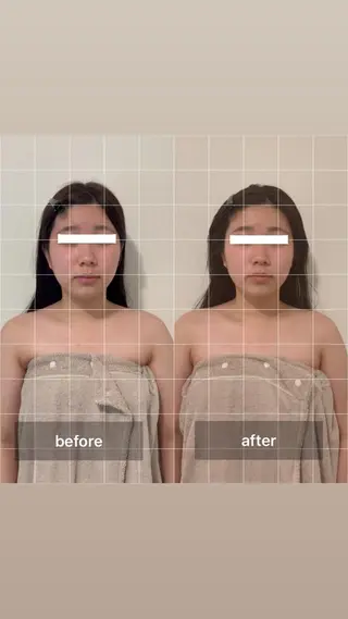 エクラヴィ 小顔・エイジングケアのエステ・リラクイメージ