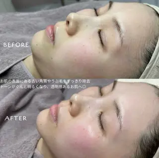 フェイシャルワックス KANAKOのエステ・リラクイメージ