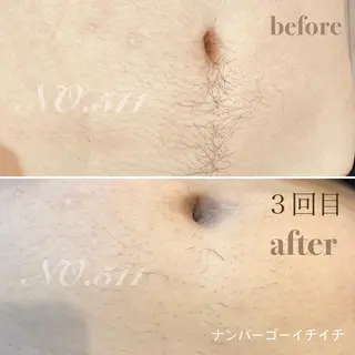 メンズ 脱毛&フェイシャル NO.511のエステ・リラクイメージ