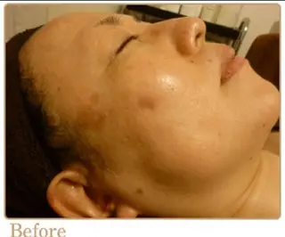 ピーリングサロン シャンテールのエステ・リラクイメージ