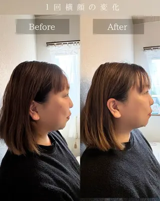 Noelie所属・美肌&小顔矯正 Noelieのエステ・リラクイメージ