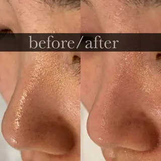 FOXYLASH inoueのエステ・リラクイメージ