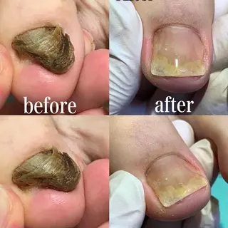 ネイル 東京巻き爪 アカデミーのエステ・リラクイメージ