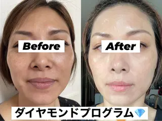 肌質改善サロン★ リュー・ド・ボウテのエステ・リラクイメージ