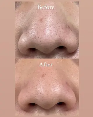 sharesalon PESCAのネイルデザイン