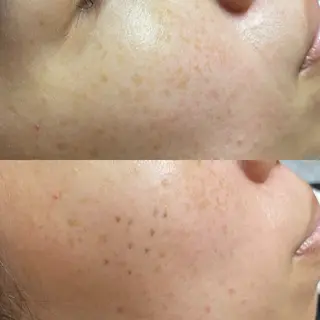 曽根 理奈のエステ・リラクイメージ