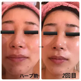fairyrose organicエステのエステ・リラクイメージ