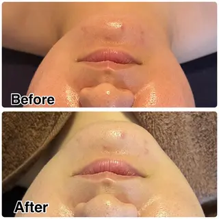 🌴Beauty Salon LANAのエステ・リラクイメージ