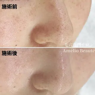 毛穴ケア専門サロン アメリオボーテのその他イメージ