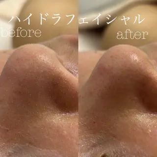 フェイシャルサロン CHIARA 荒田のエステ・リラクイメージ