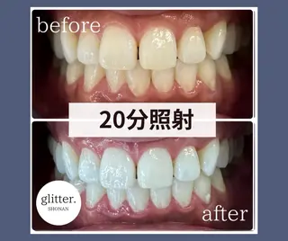 ネイル ホワイトニング専門店 glitterのその他イメージ