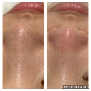 BeautySalonGemmy所属・Gemmy 愛美のエステ・リラクイメージ