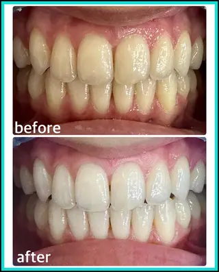 ホワイトニングサロン ラウレアのその他イメージ