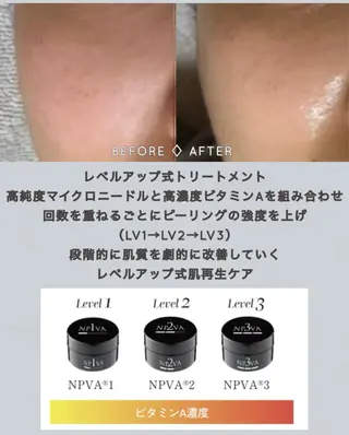 ヴィーナス ビューティーのエステ・リラクイメージ