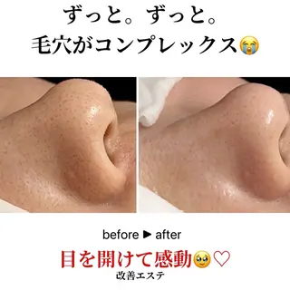 +M所属・竹ノ内 理恵のエステ・リラクイメージ