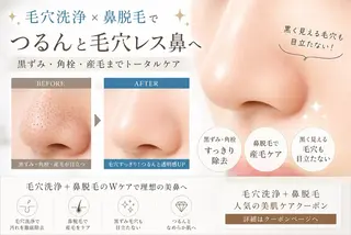 痩身・脱毛・肌管理 Rechica心斎橋のエステ・リラクイメージ