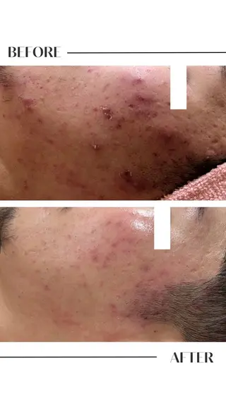 フェイシャル/脱毛 ジョアアンジェ竹田のエステ・リラクイメージ