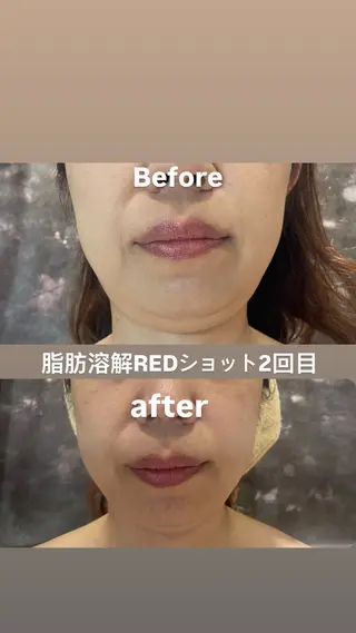 Beautysalonプルメリア所属・エステ プルメリアのエステ・リラクイメージ