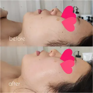 Shiny ✧︎*。のエステ・リラクイメージ