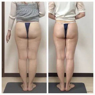 セルライトクラッシュ ＆腸もみ＋骨盤矯正のその他イメージ