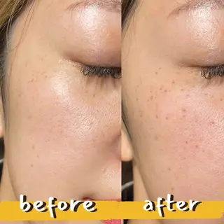 曽根 理奈のエステ・リラクイメージ