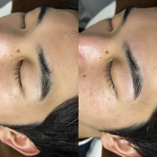 アイブロウ Mr.&Ms. 脱毛 /眉毛ワックス/まゆのエステ・リラクイメージ