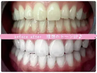 エクシア ホワイトニング西条店のその他イメージ