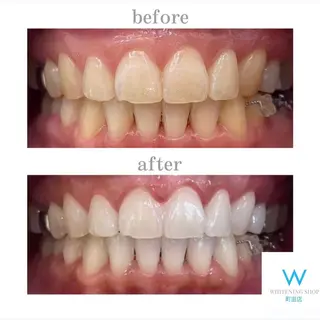 メンズ キッズ ホワイトニング ショップ町田店のその他イメージ