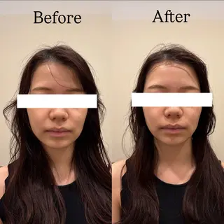 seika🍒 ハリラウンジ梅田のエステ・リラクイメージ