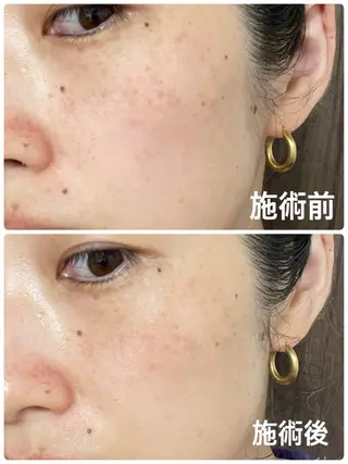 坂田(山下) 澄香のネイルデザイン