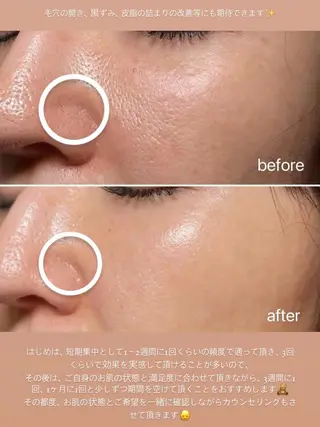 ナスサロasuka. 🕯️🤎のエステ・リラクイメージ