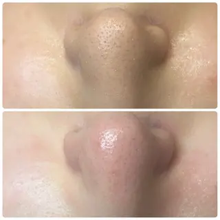 uni. beautyのエステ・リラクイメージ