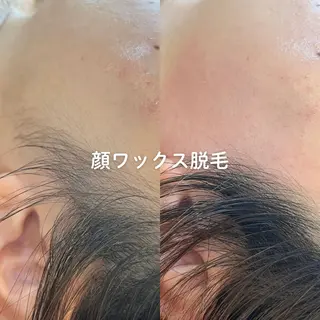 顔ワックス脱毛/ ハーブピーリングのエステ・リラクイメージ