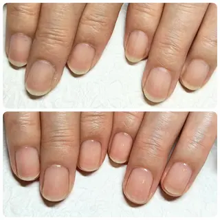 ネイル 深爪矯正/爪育成ケア manie nailのネイルデザイン