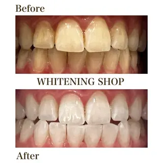 ホワイトニング ショップ銀座7丁目店のその他イメージ