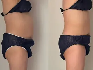 温活痩身美肌エステ サロンkiraraのエステ・リラクイメージ