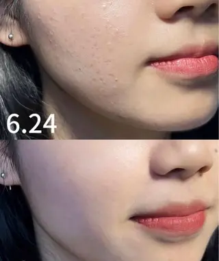 愛維美水光美肌専門店所属・愛維美水光美肌専門店 メンズレディースokのエステ・リラクイメージ