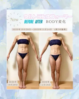 エステサロン lx(ルクス)のエステ・リラクイメージ